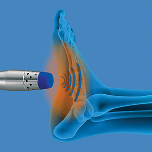enPuls - Radial Shockwave Therapy