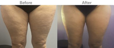 Z Wave Before & After - Sophia Front - A to Z News