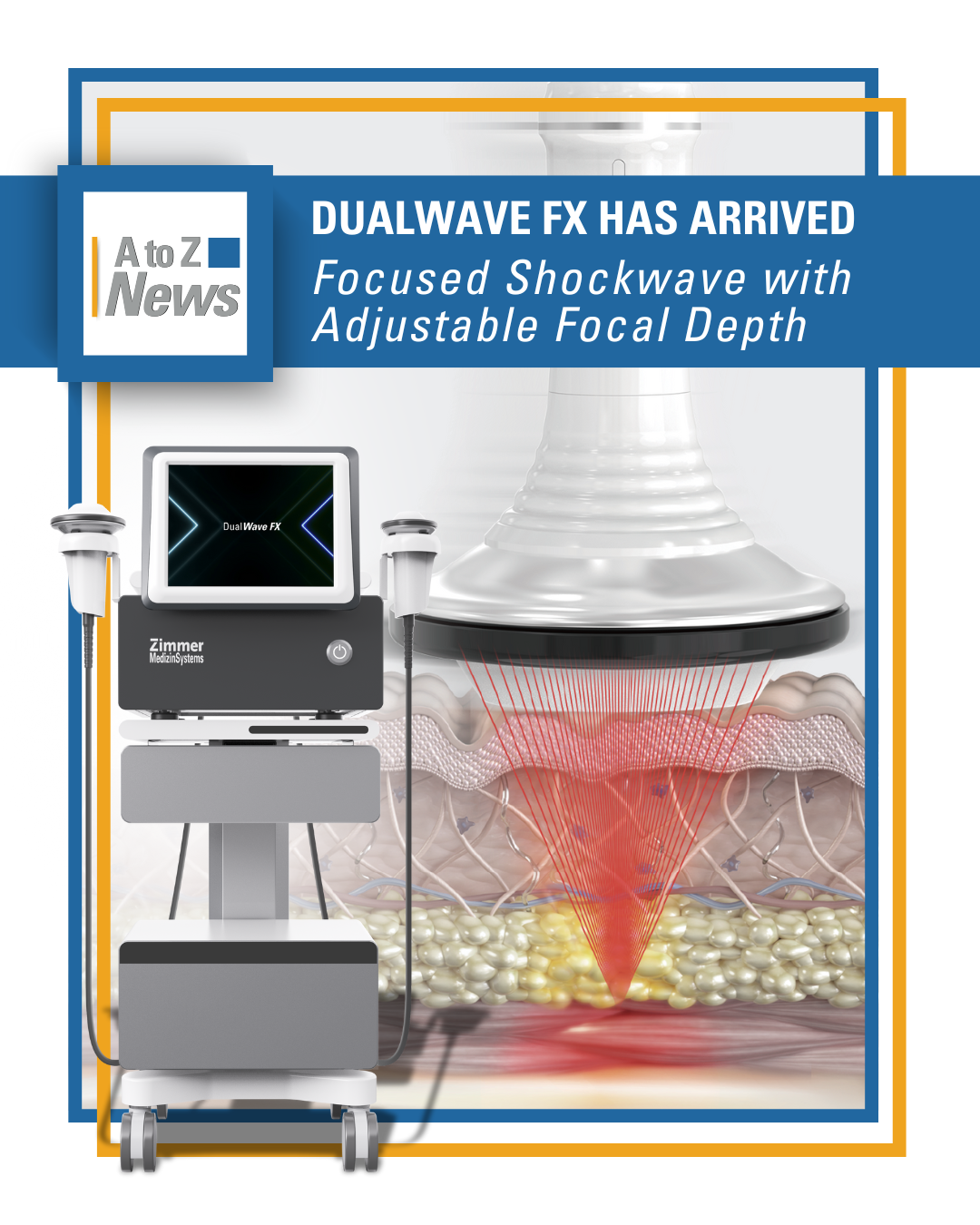 Introducing DualWave FX: Focused Shockwave with Adjustable Focal
