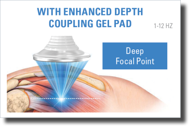Enhanced depth coupling pad