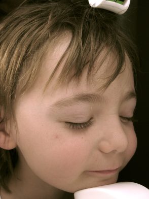 Dr. Joel Cohen’s three-year-old son during pulsed-dye laser treatment for a spider angioma